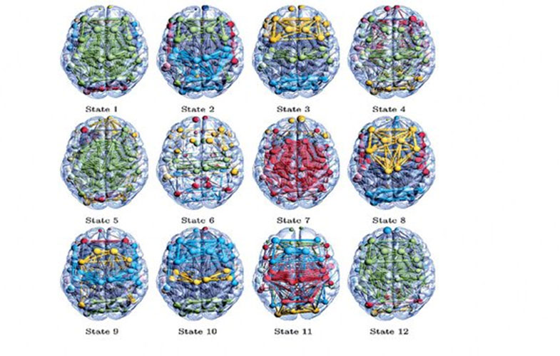 کشف ۱۲ حالت مخفی در مغز
