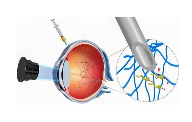 دارورسانی مستقیم از چشم توسط ربات‌های کوچک
