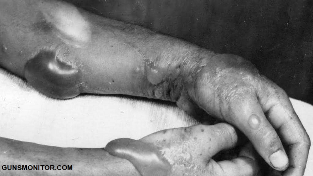 10 واقعیت درباره گازهای شیمیایی طی جنگ جهانی اول