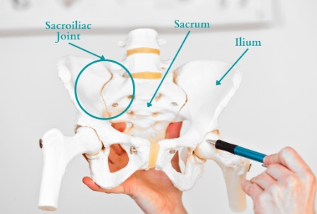 درد مفصل ساکروایلیاک (SI)؛ دردی که نشستن را سخت می کند