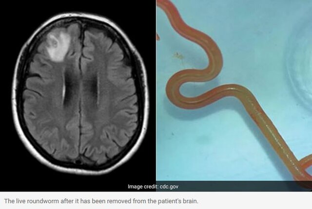 کشف کرم زنده در مغز بیمار استرالیایی/نگرانی پزشکان از رشد امراض مشترک بین انسان و حیوان